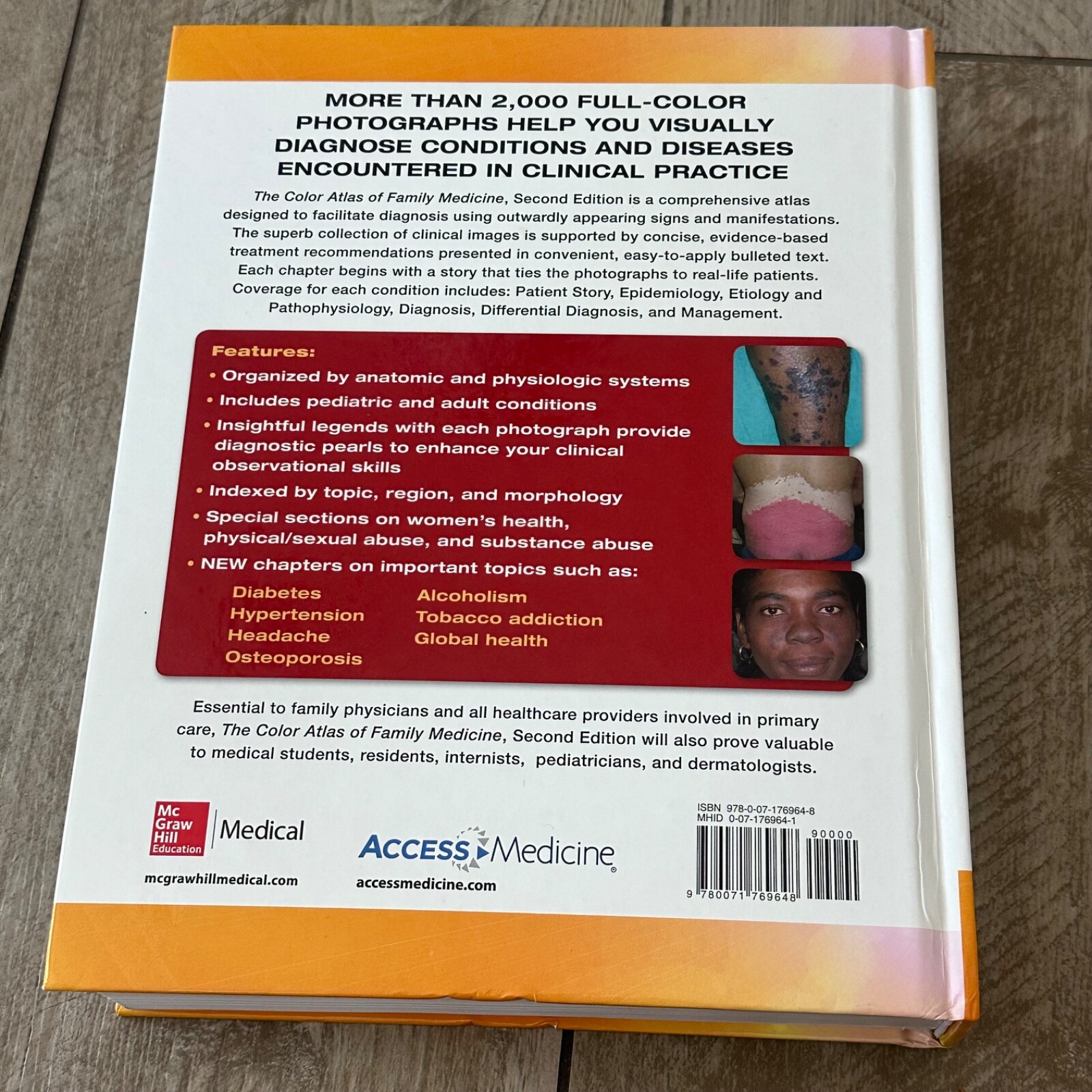 Color Atlas of Family Medicine 2/e by Mindy Ann Smith, Richard P. Usatine, E. J.