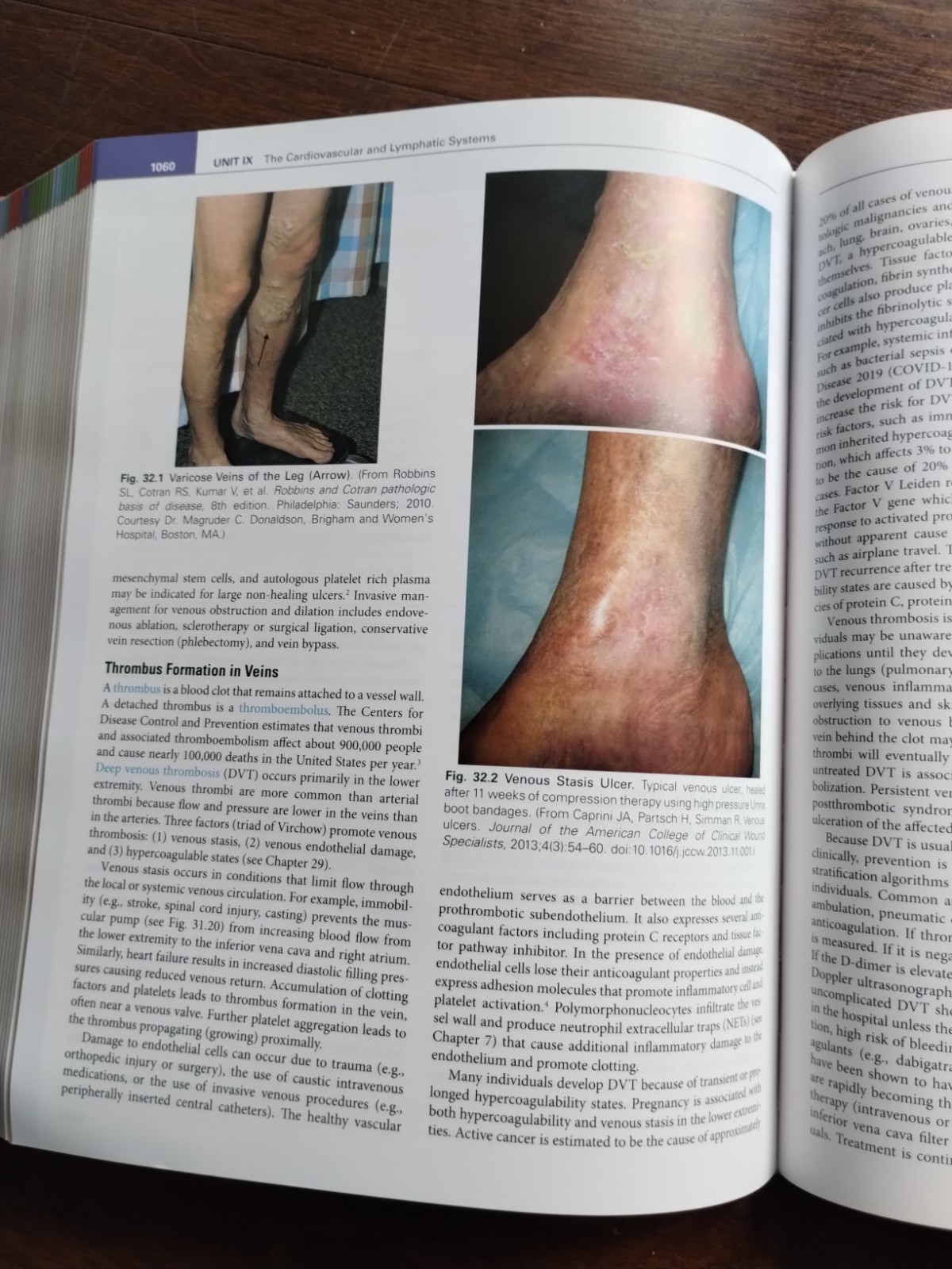 McCance & Huether’s Pathophysiology 9th Edition, Julia L. Rogers